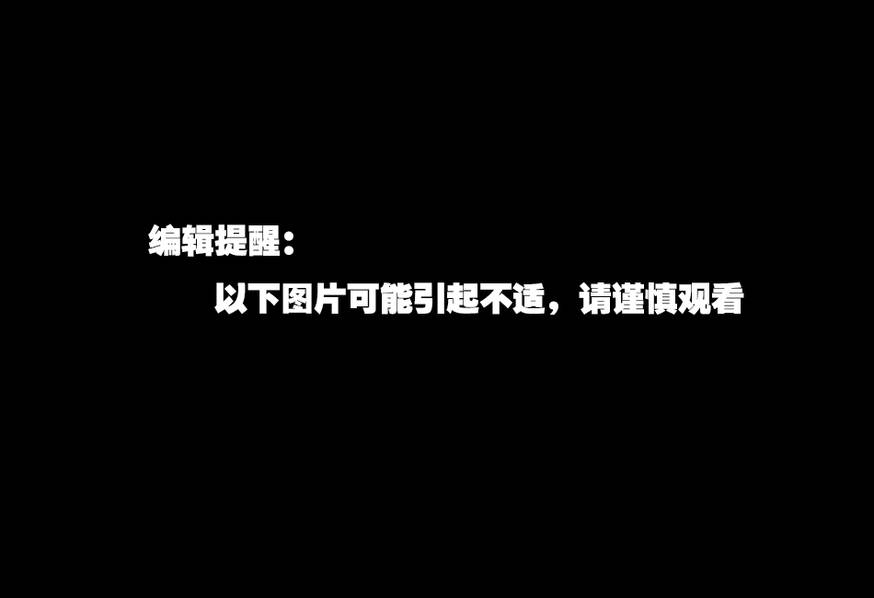 叙利亚村庄遭毒气袭击 93死300伤 国际 第2张